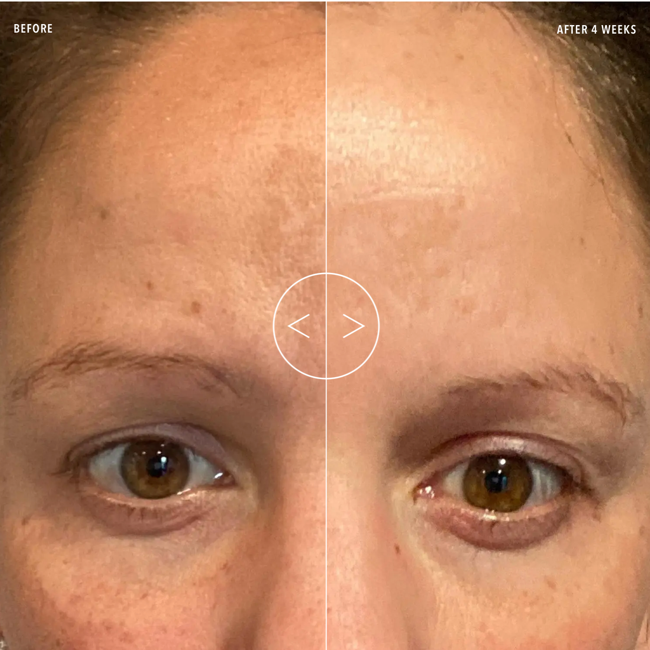 Before and after comparison of a person's eye area with visible improvement over 4 weeks.