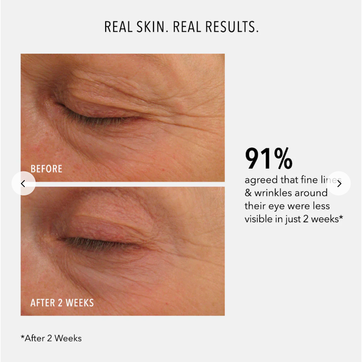 Before and after comparison of eye area with text about fine lines and wrinkles reduction.