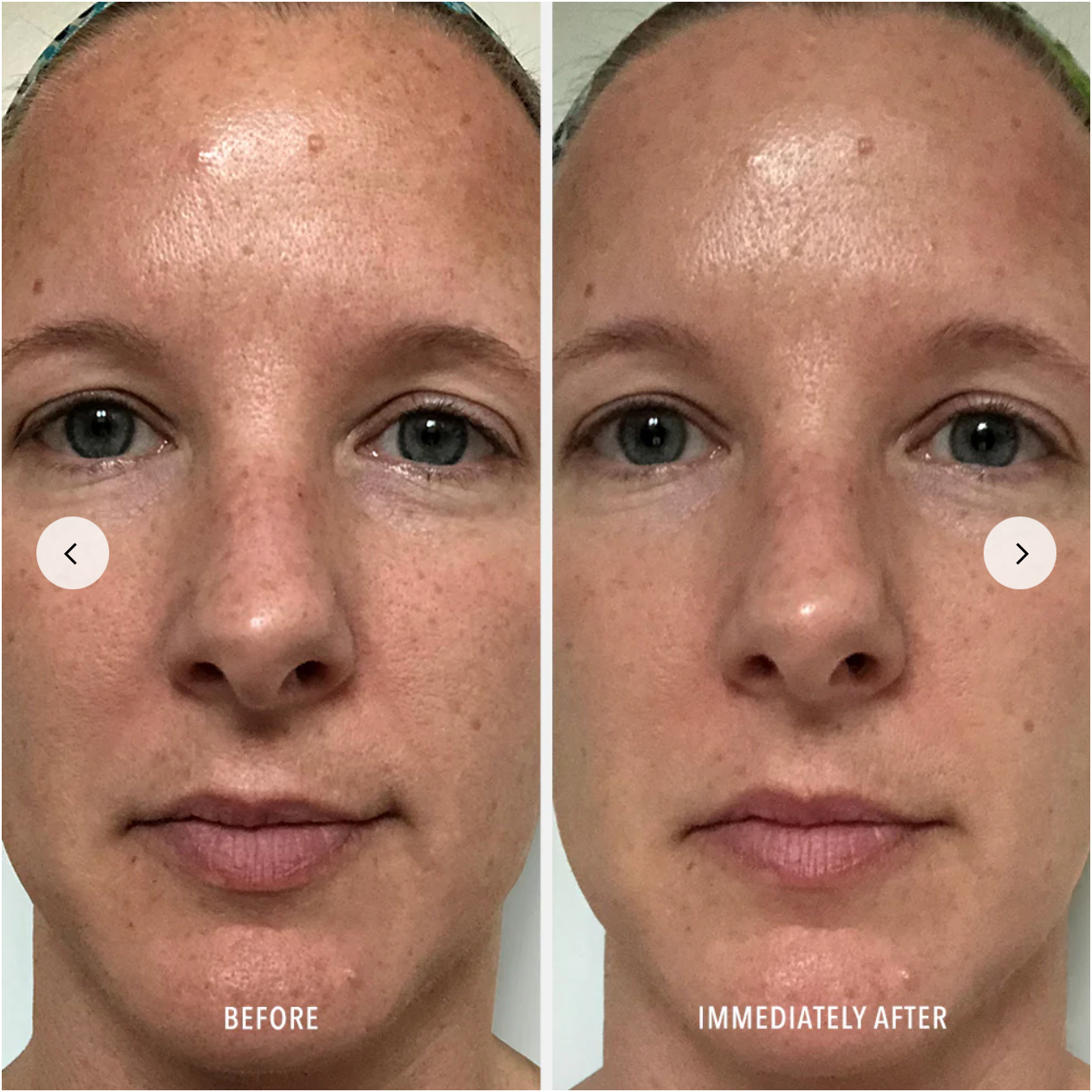 Before and after comparison of a person's face with visible skin texture changes.