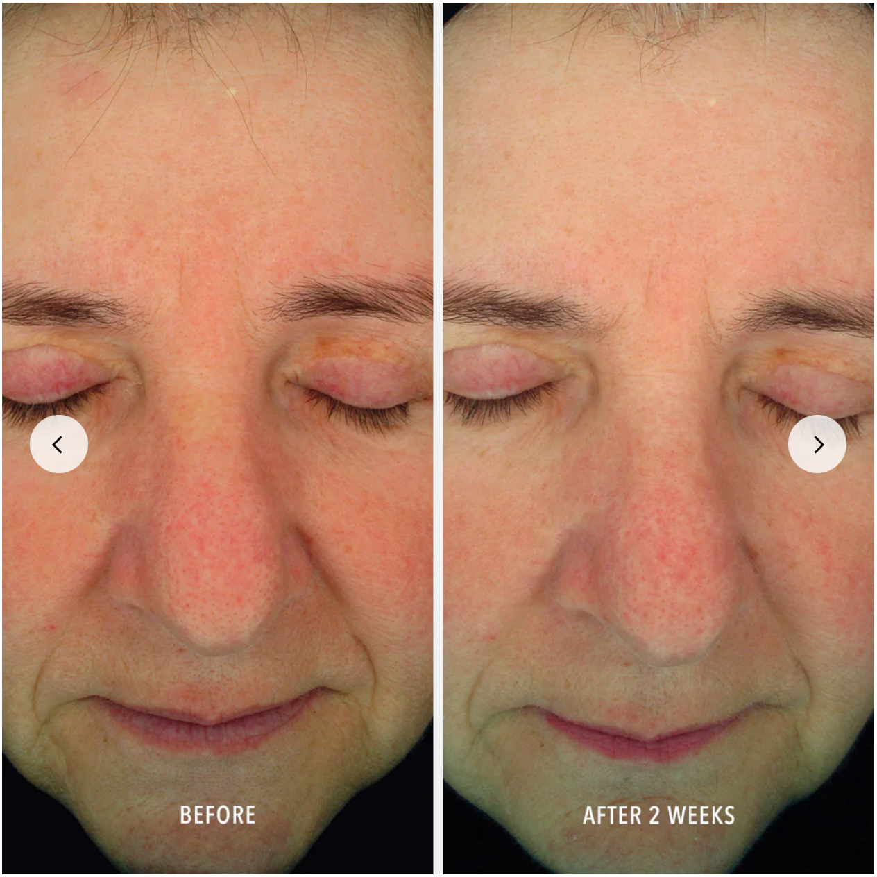 HP Beruhigendes Serum - Reparatur und Linderung von Rötungen (Sensitive Line)