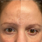 Before and after comparison of a person's eye area with visible improvement over 4 weeks.