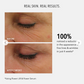 Before and after comparison of eye area skin with text about reduction in fine lines and wrinkles using Power Lift & Power Serum.