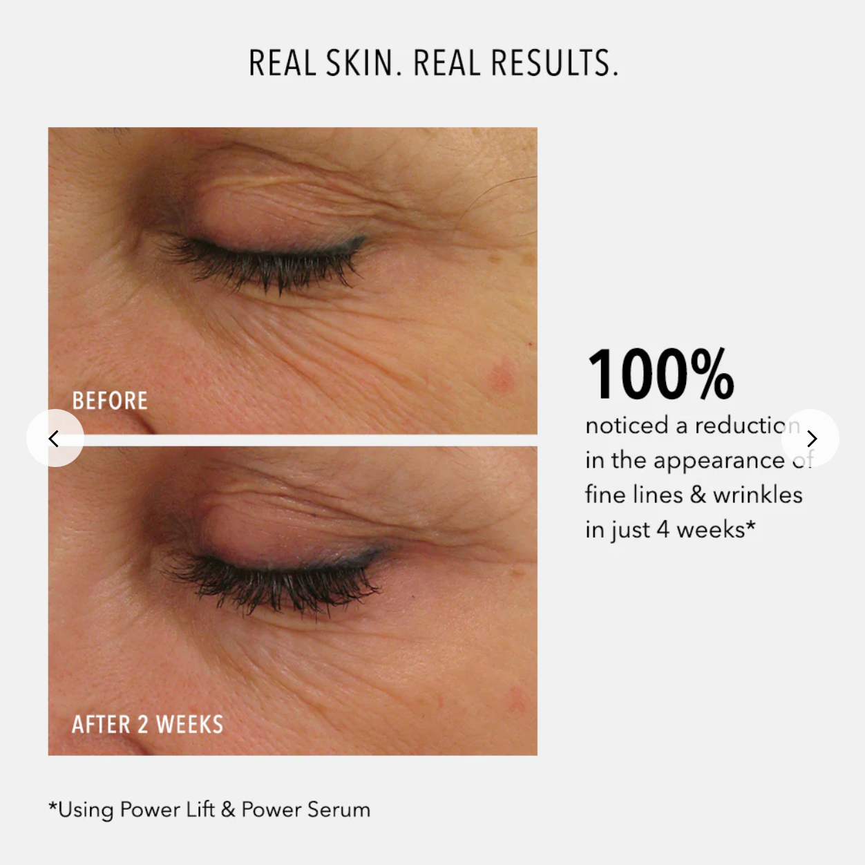 Before and after comparison of eye area skin with text about reduction in fine lines and wrinkles using Power Lift & Power Serum.