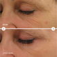 Before and after comparison of a person's eye area with visible skin texture changes over two weeks.