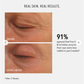 Before and after comparison of eye area with text about fine lines and wrinkles reduction.