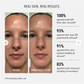 HP Anti-Wrinkle - Polish & Plump Peel (2stage peeling)