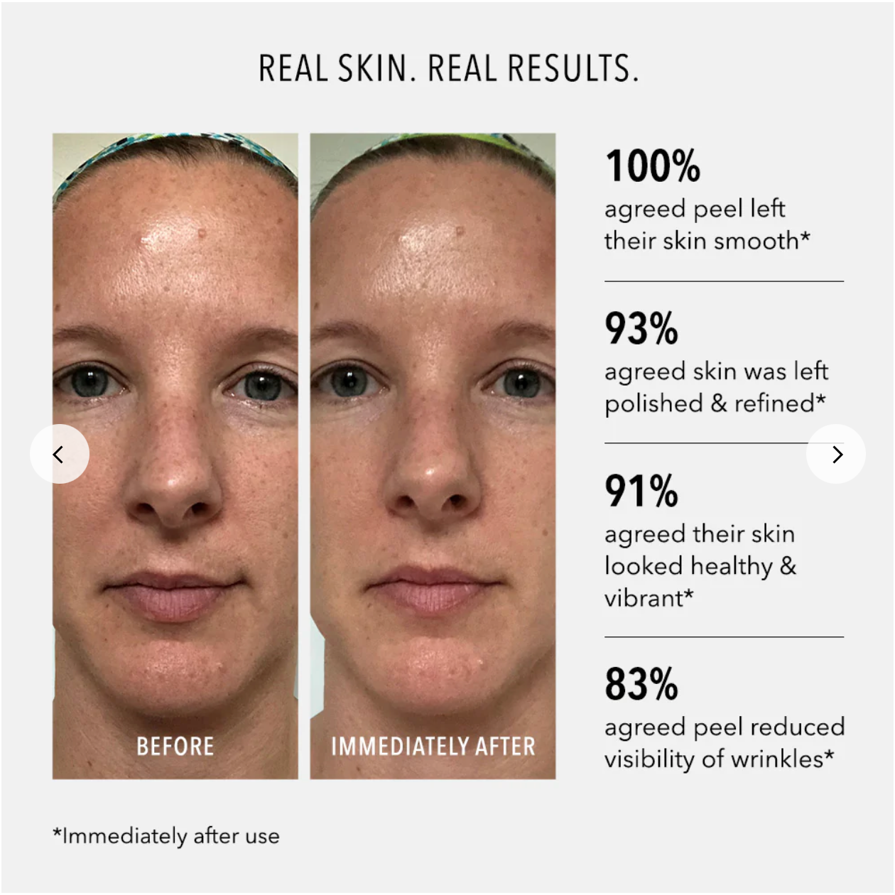 HP Anti-Wrinkle - Polish &amp; Plump Peel (2stage peeling)