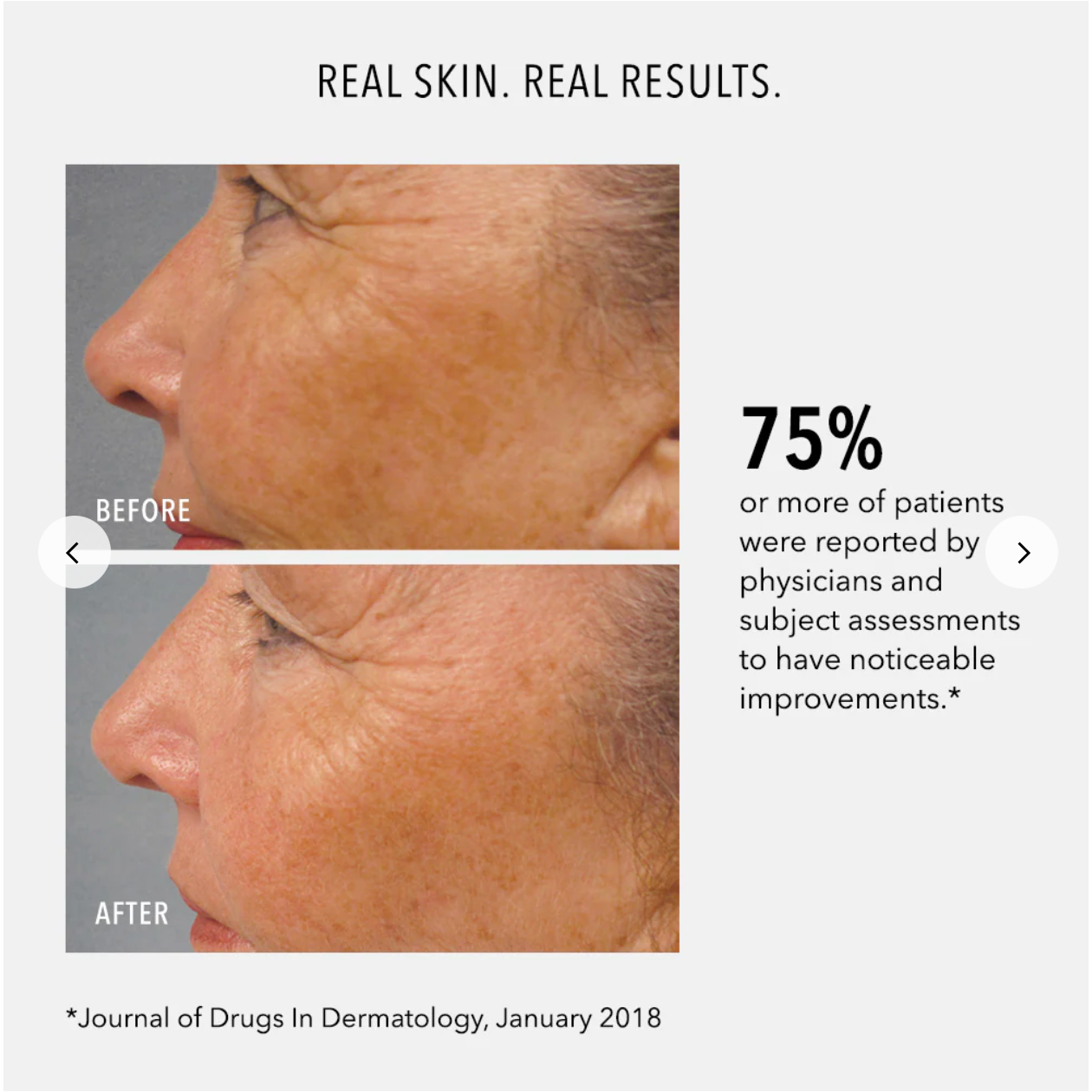 HP LumaPro-C - Skin Brightening Pigment Corrector