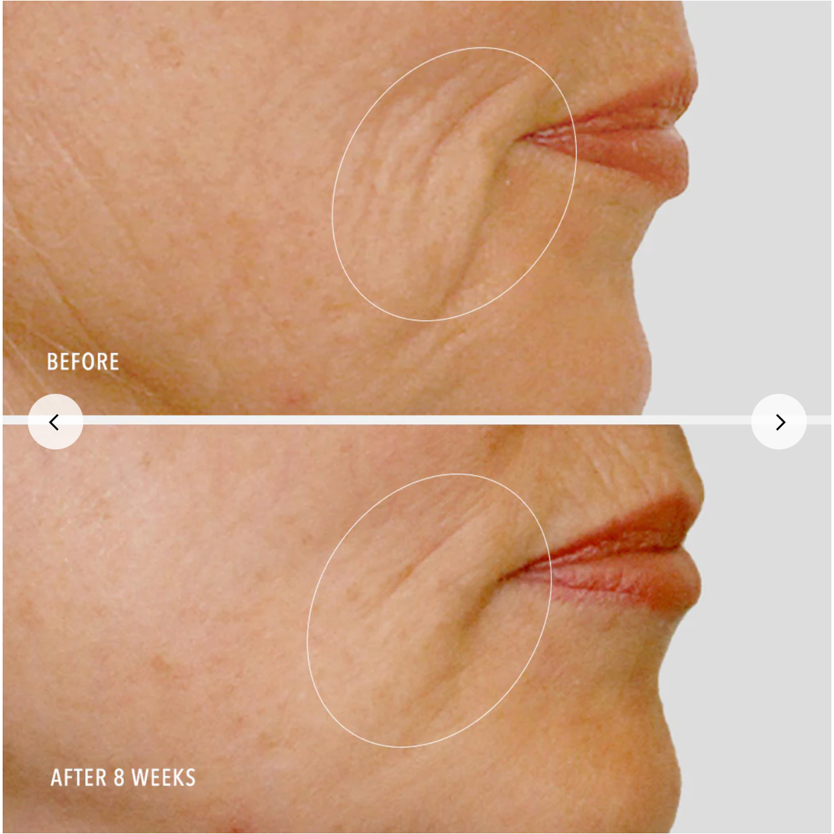 Lips before and after cosmetics