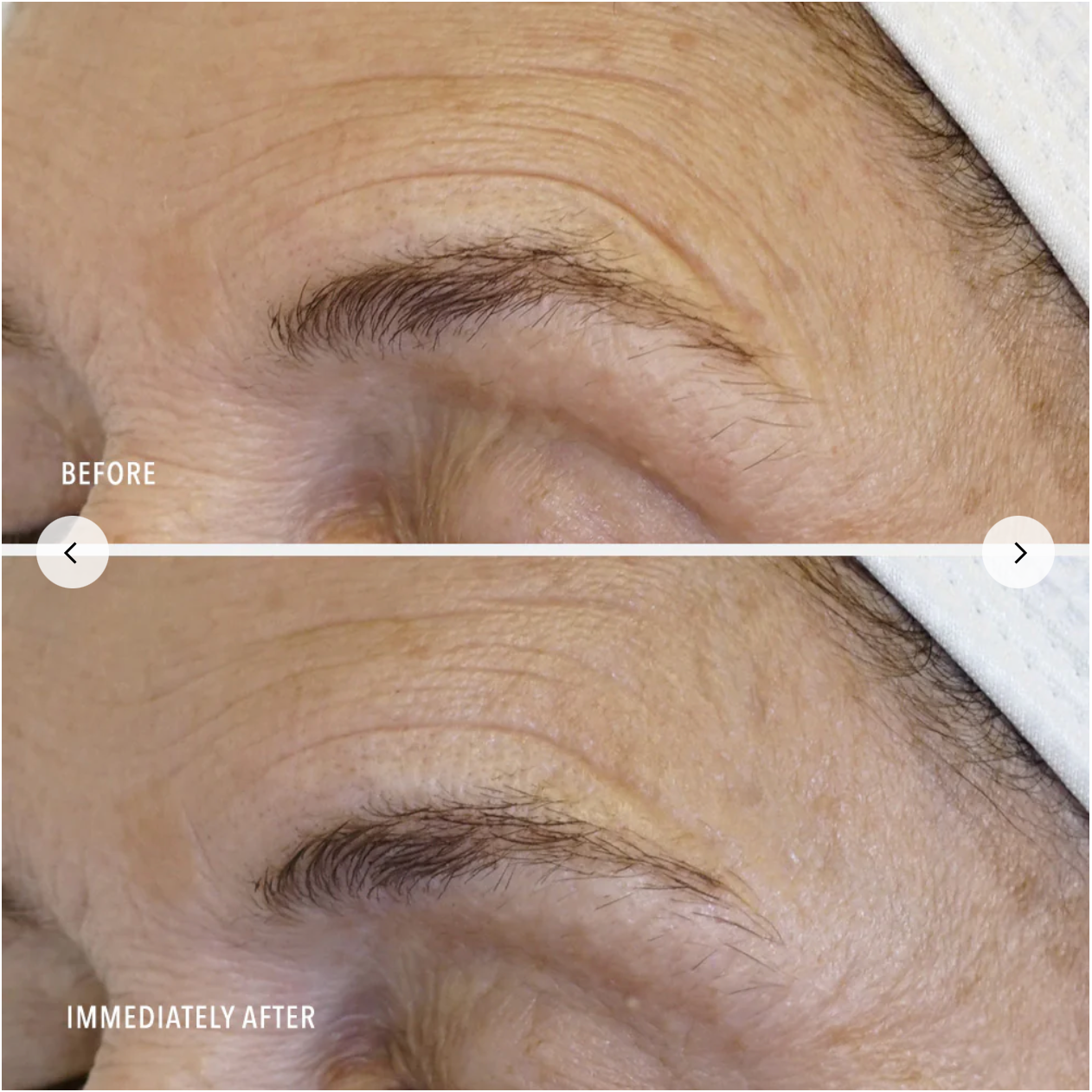 HP Daily Drench- Hyaluronic Acid Peptide Booster (Restore Line)