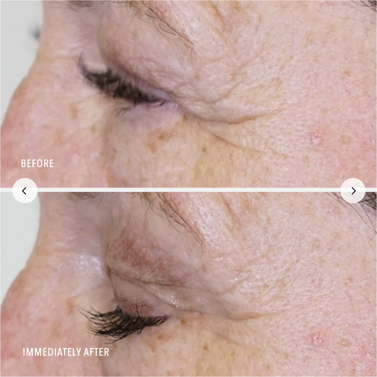 HP Daily Drench- Hyaluronic Acid Peptide Booster (Restore Line)