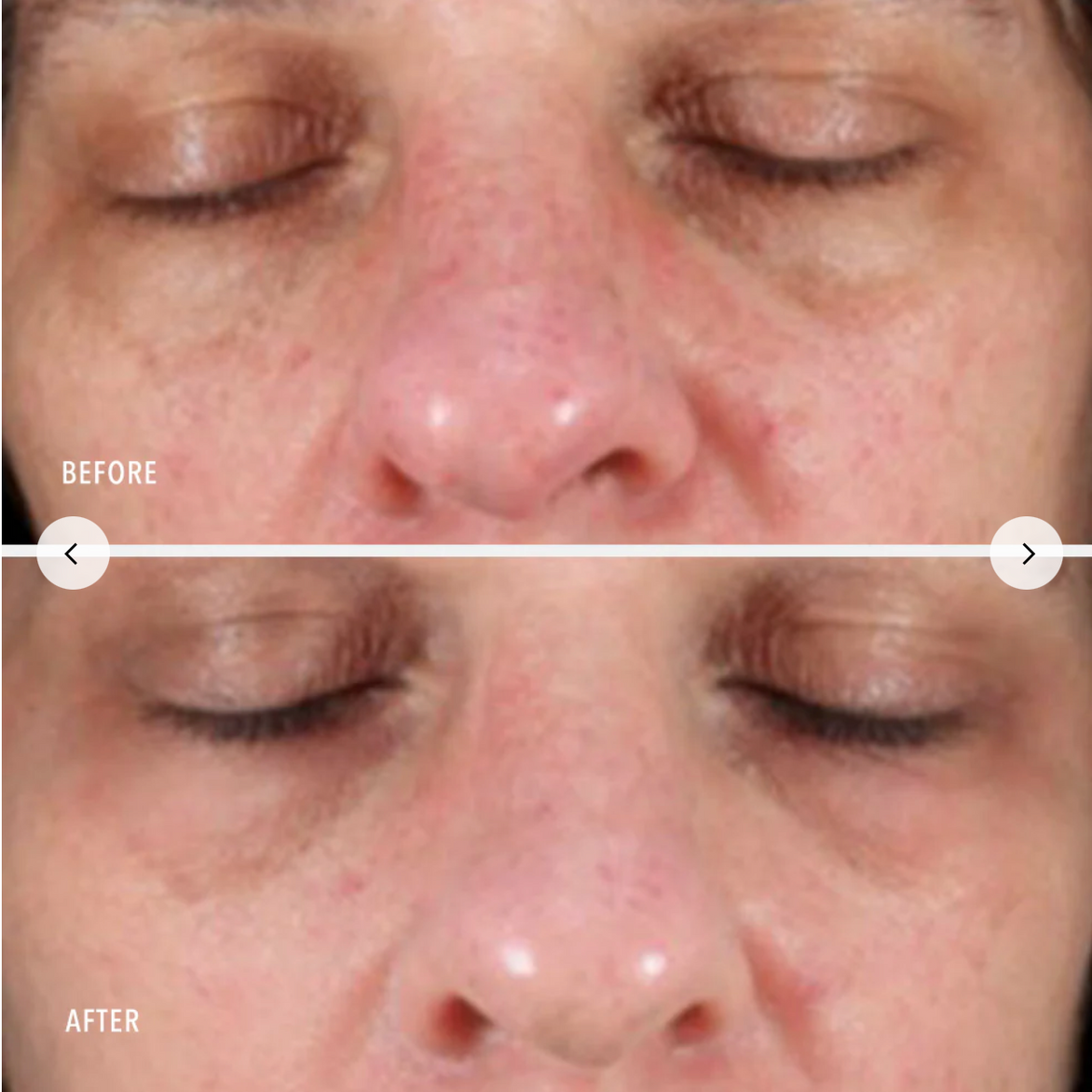 Face before and after 01