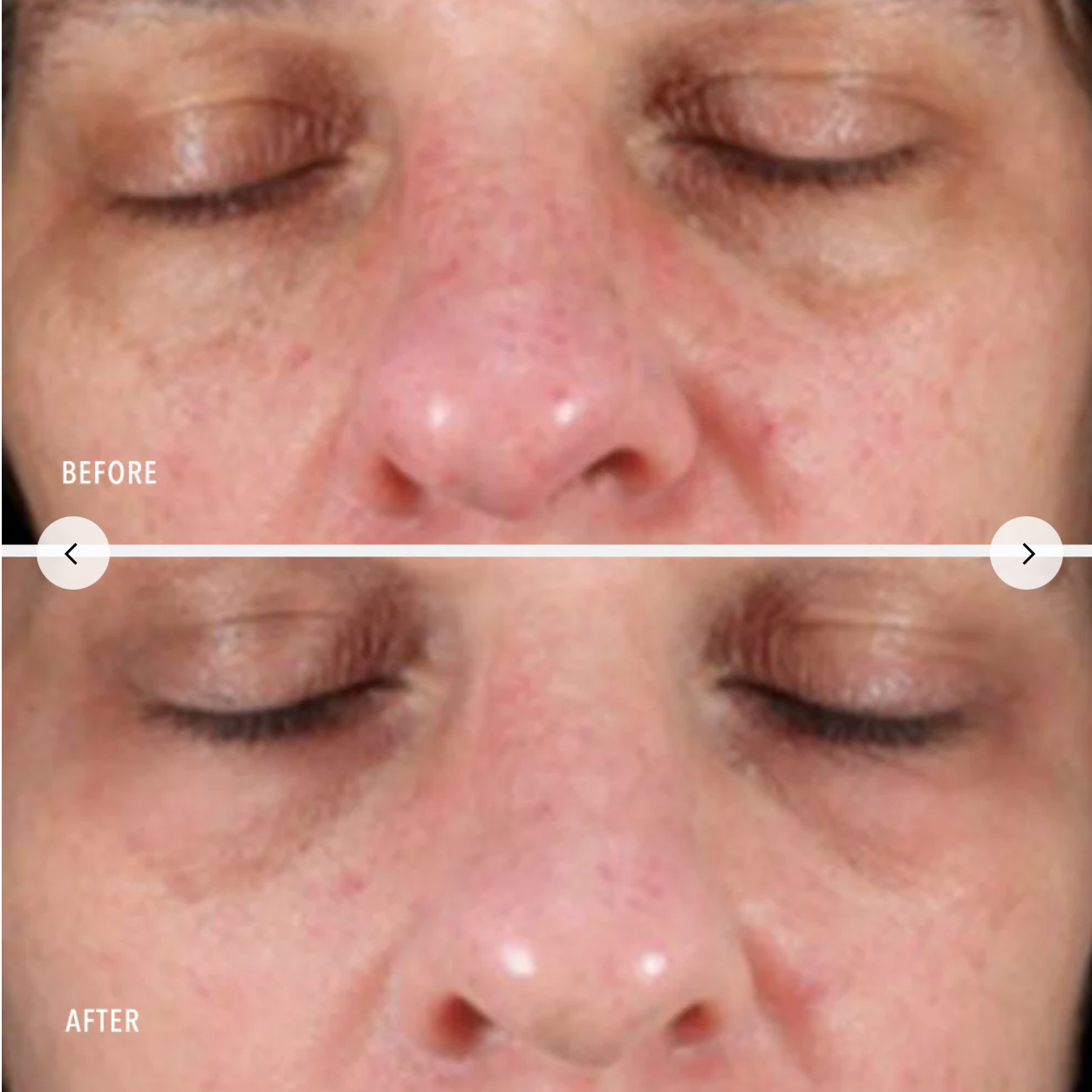 Face before and after 01