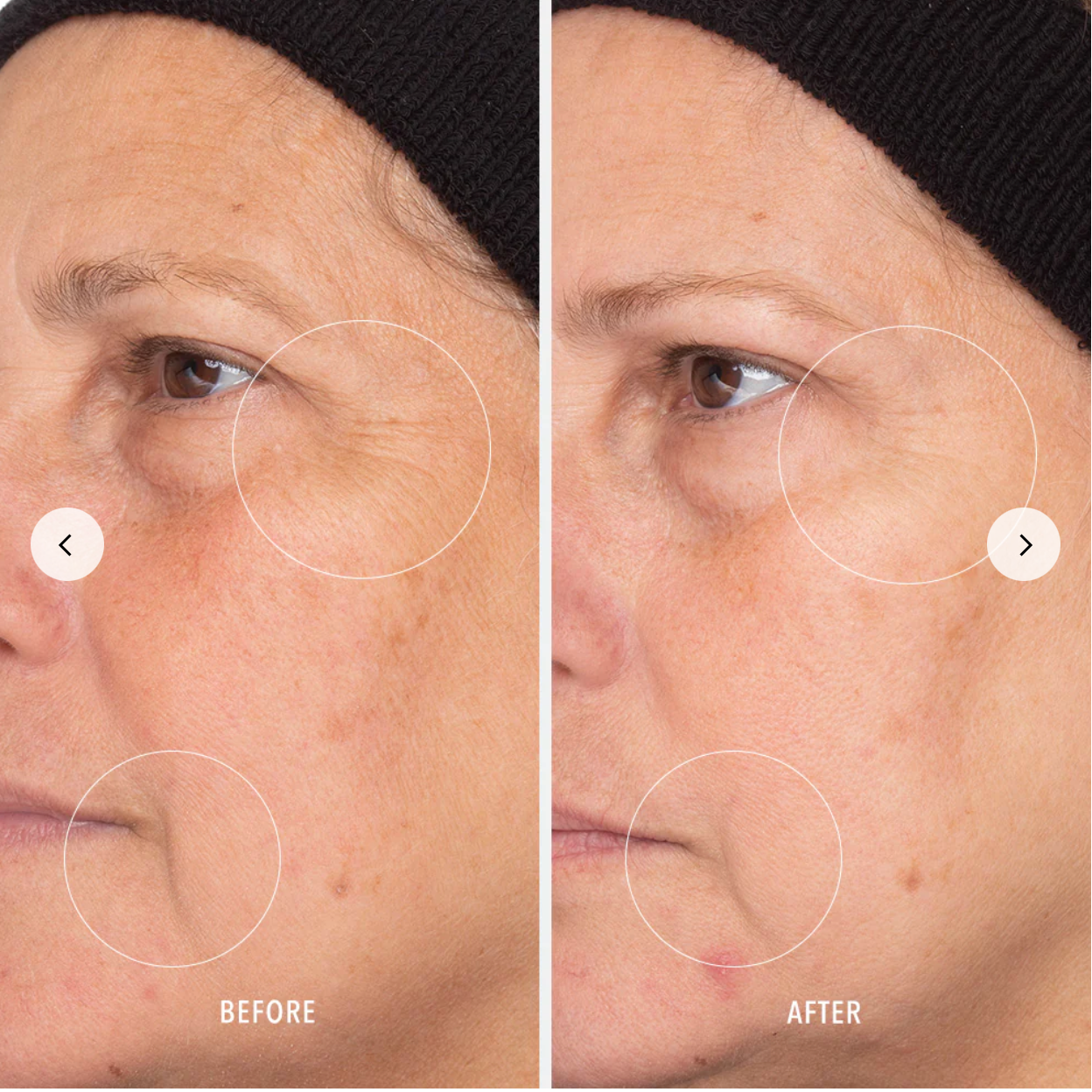 Retinol Routine Booster 1% Retinol Solution