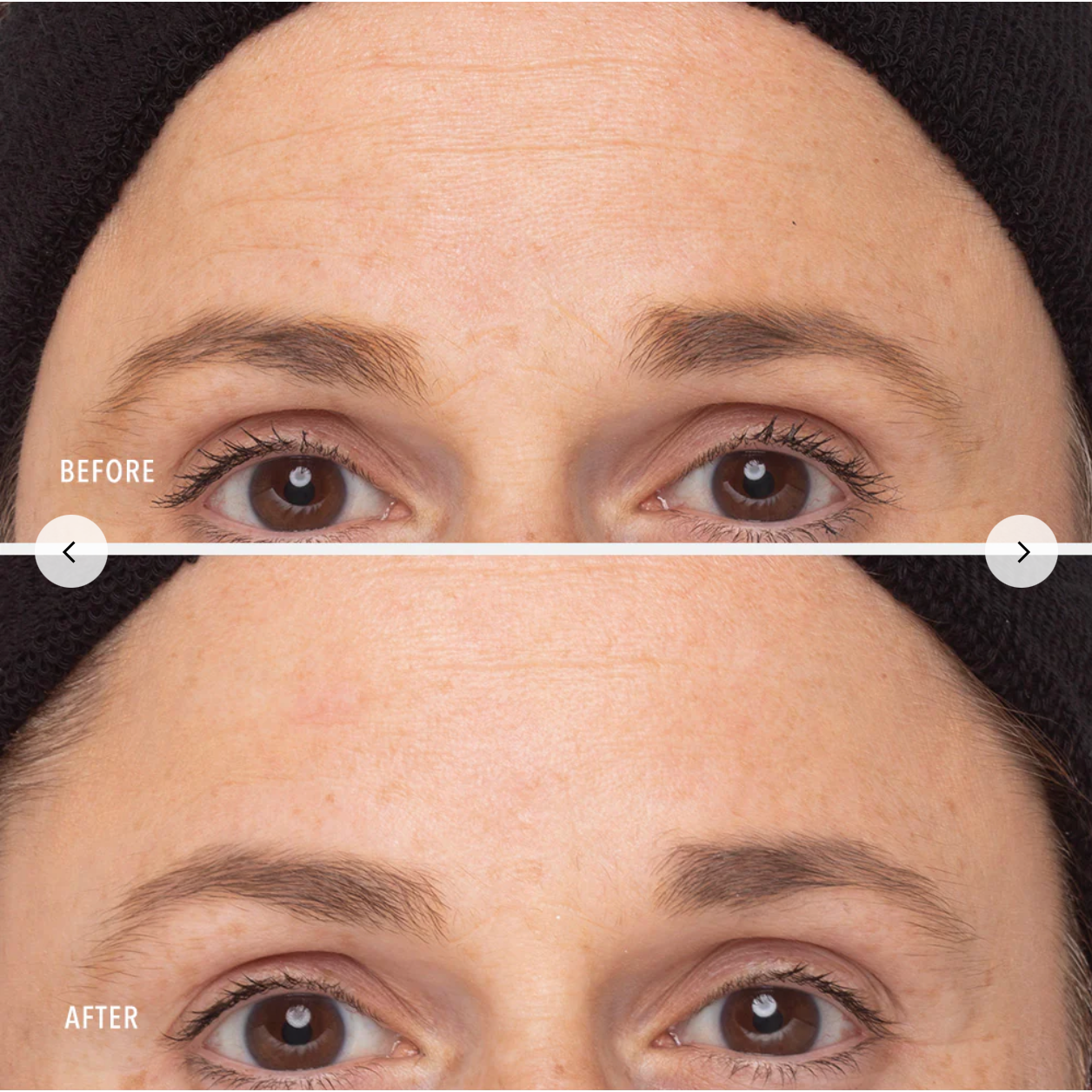 Retinol Routine Booster 1% Retinol Solution