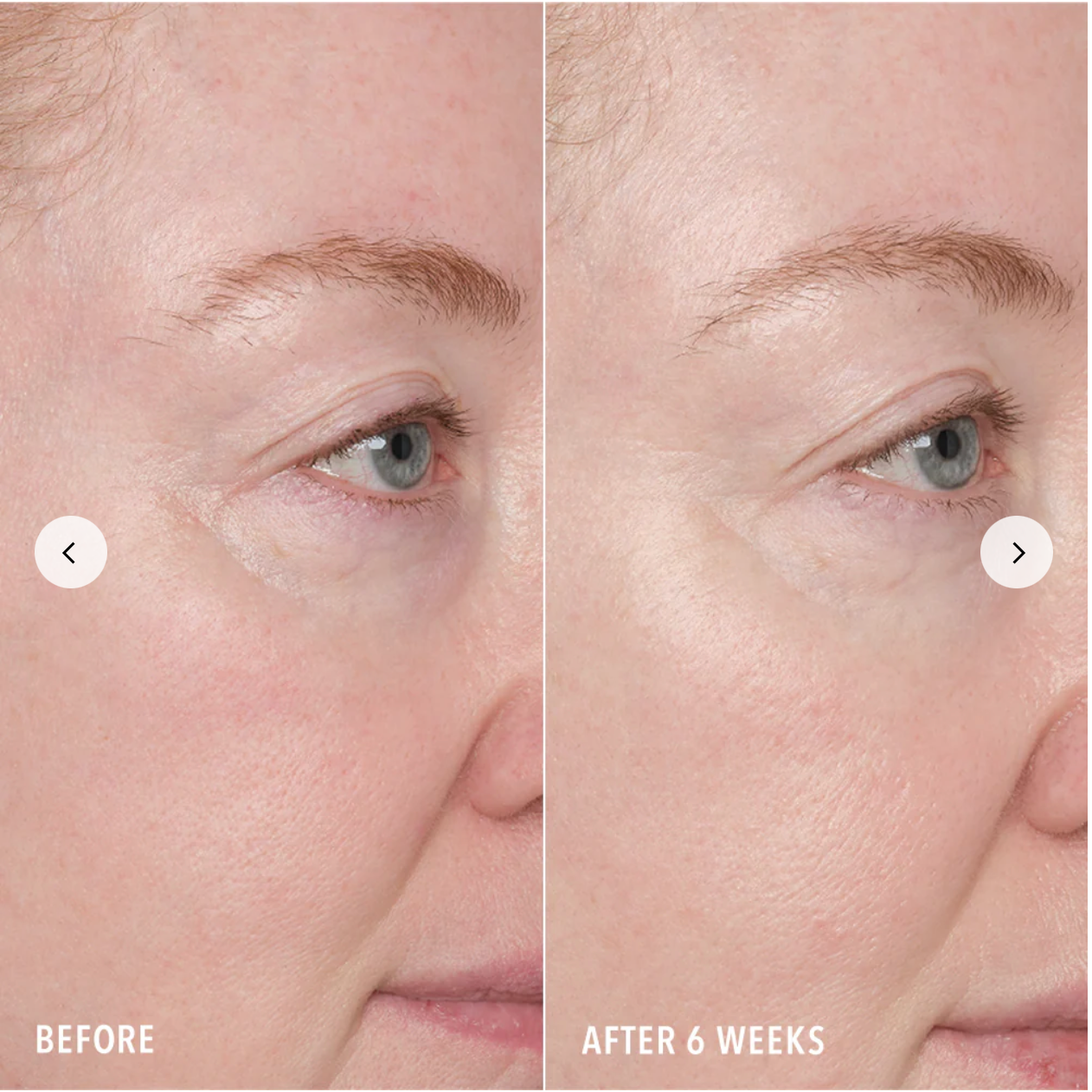 Hydropeptide Resurface and Repair Peptide Pads (30 treatments)