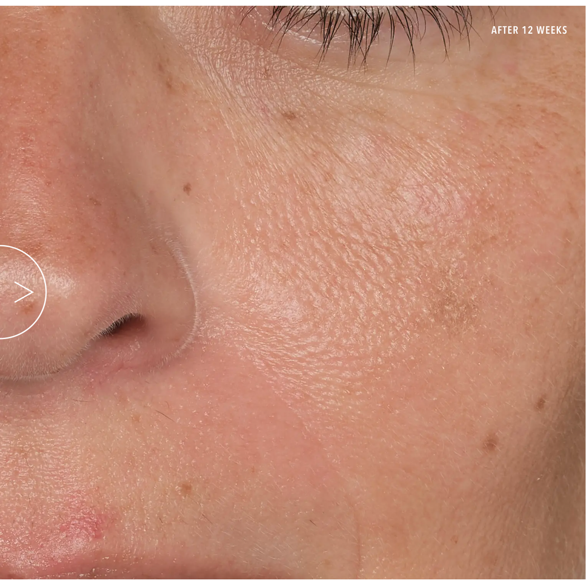 HydroPeptide Syner-C+ – Multi-Action Vitamin C Aufhellendes Serum